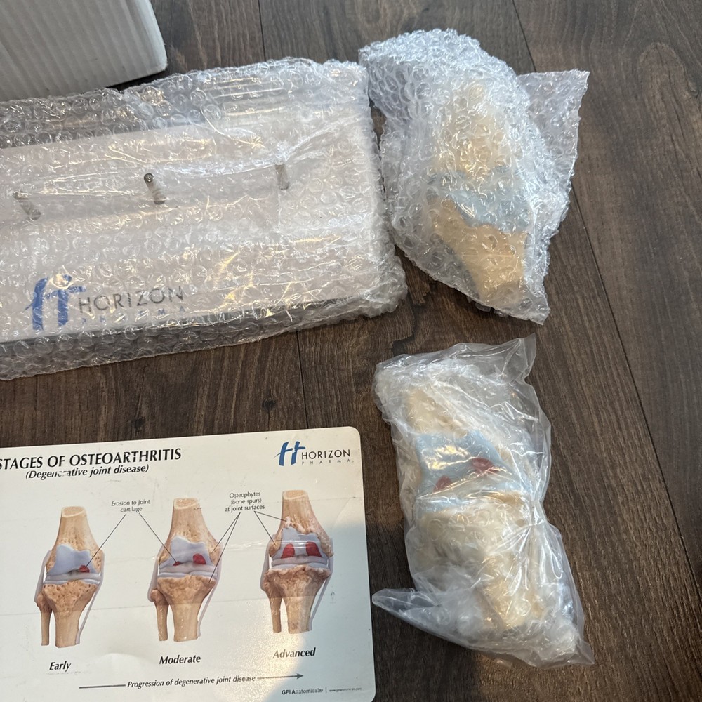 Knee Joint Osteoarthritis GPI Model Set horizon pharma