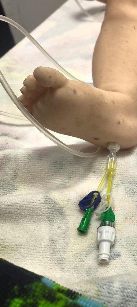 Laerdal SimBaby Light Medical Training Mannequin