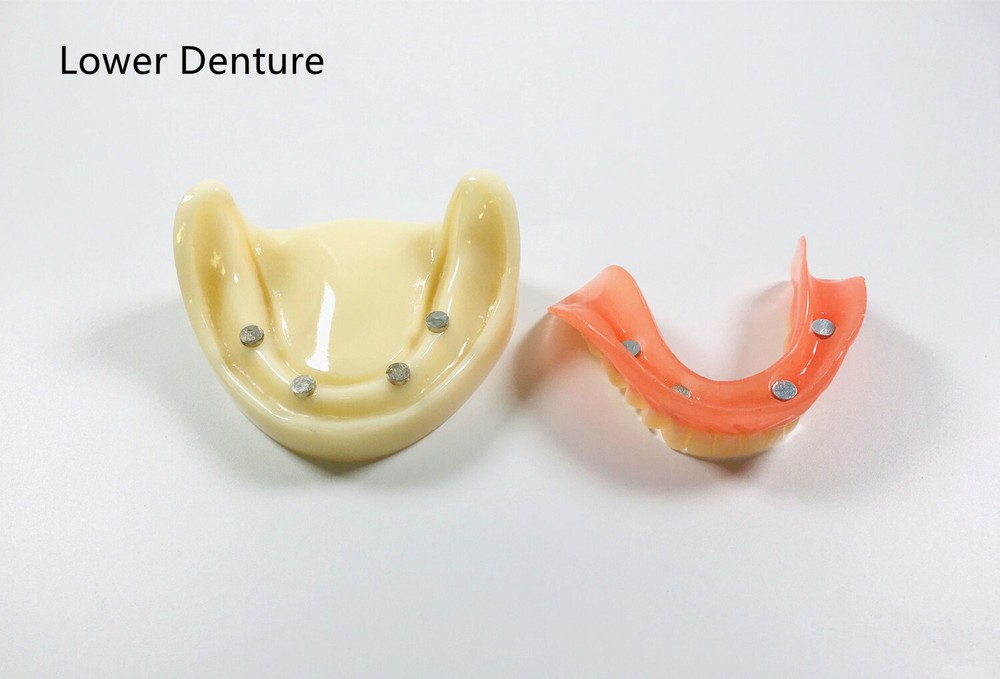 Dental Full Denture Model Magnetic Attachment Mandibular Upper/Lower Study