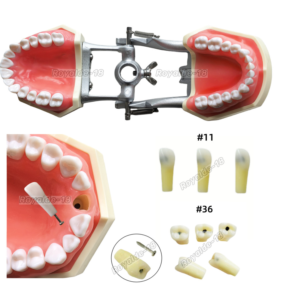 Dental Caries Remove Teeth Model Decayed Removing Practise Dentist Student Test