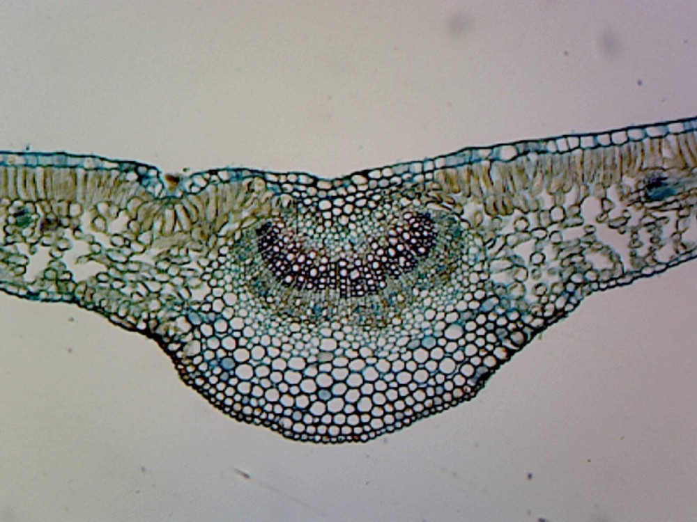 Microscope Slide with Specimen of Ligustrum Leaf; Showing Typical Mesophytic