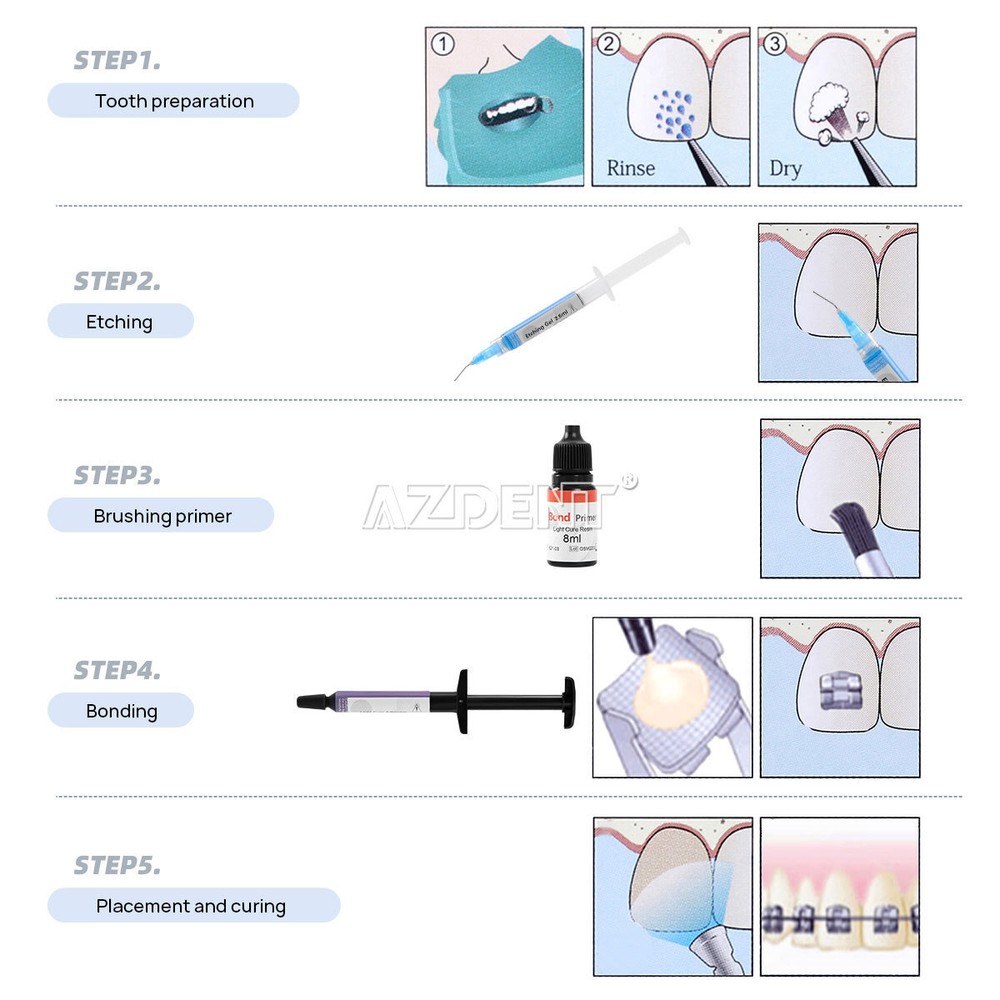 Dentex Dental Ortho Bracket Cure Light Composite Etching Adhesive Etching GelKit