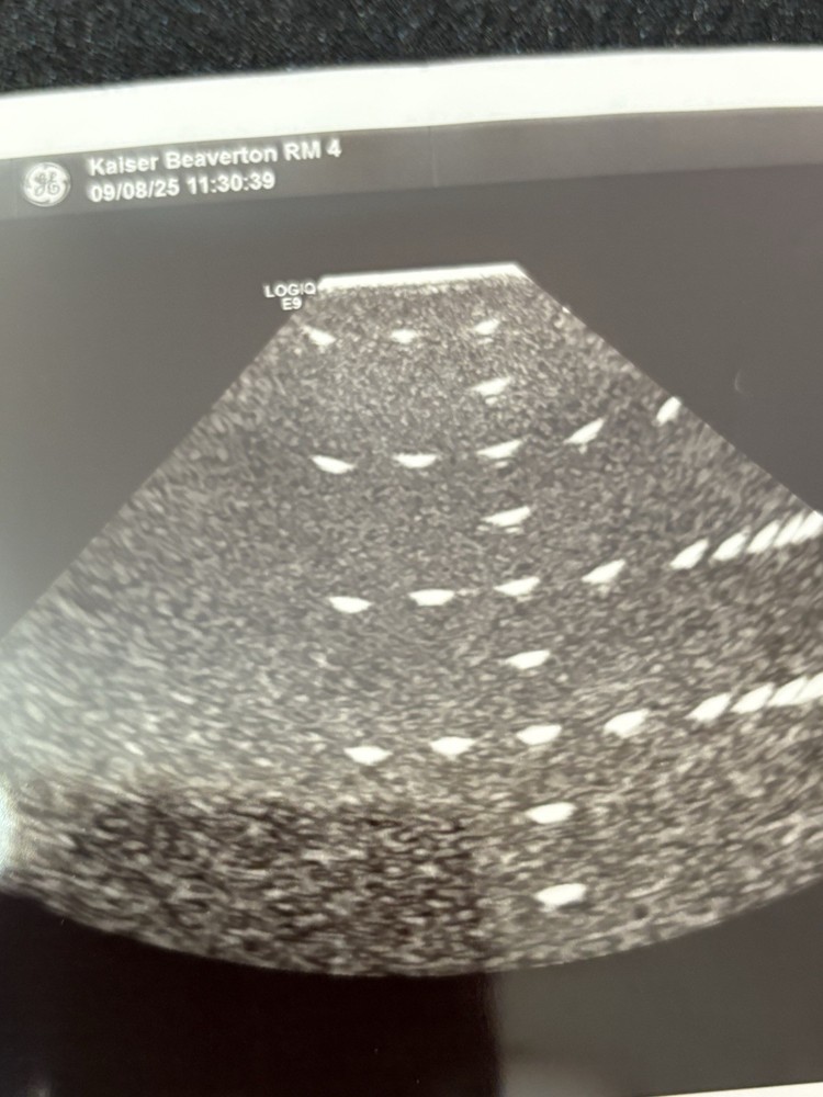 GE S1-5-D Phased Array Transducer | Tested | 30-Day Warranty