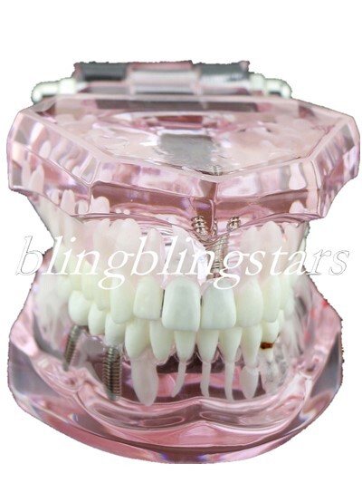 Dental Implants Training pathologies & techniques Pathological Disease Teeth