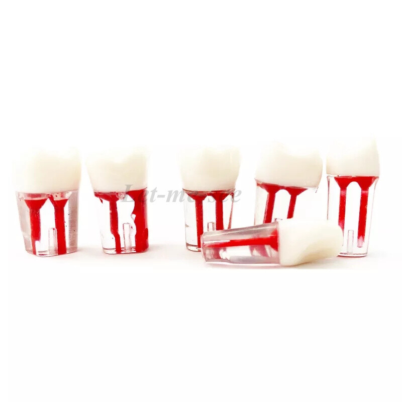 Dental Root Canal Pulp Cavity Practice Teeth Model RCT Endodontic Practice