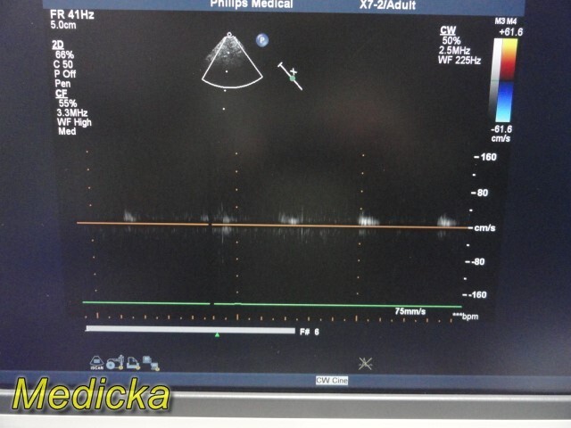 Philips X7-2 Matrix Sector Array Ultrasound Transducer Ref 453561192603 ~ 36256