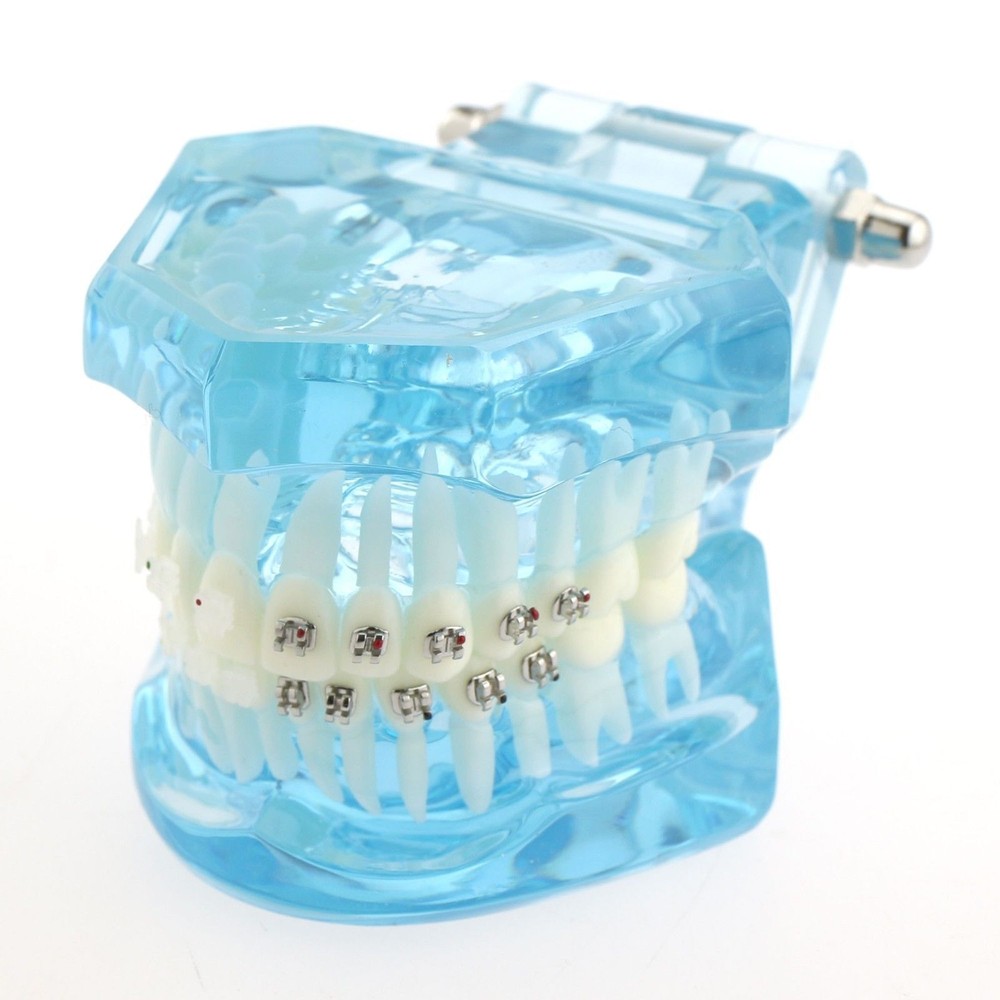 Dental Teach Study Typodont Teeth Model Half Metal Bracket Half Ceramic Bracket