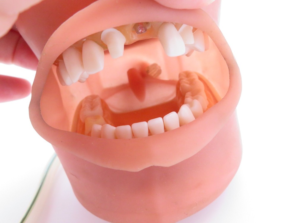 Dental Training Typodont, Dentist Practice Mouth with Teeth
