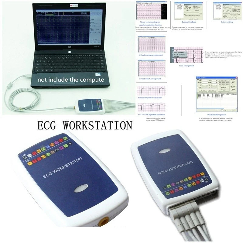 RR8000G Workstation System, 12 Lead Rest PC Based Portable ECG Machine