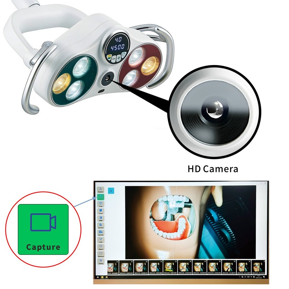 Ceiling-Mounted Dental LED Operation Light Sensor Lamp w/ Camera Video Recording