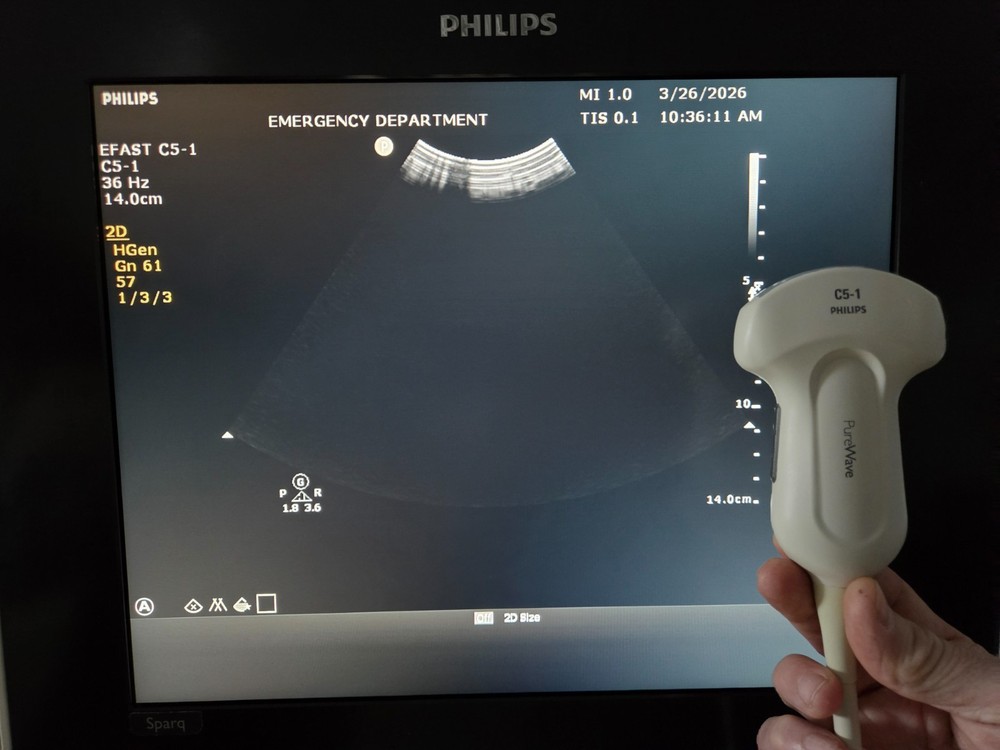 Philips C5-1 Curved Array Transducer - Working - Cord Damage