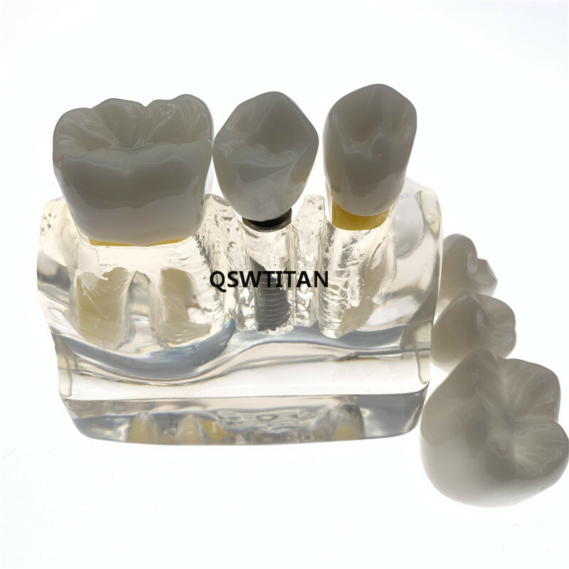 Dental Demonstration Study Teeth Model for Implant Analysis Crown Bridge Model