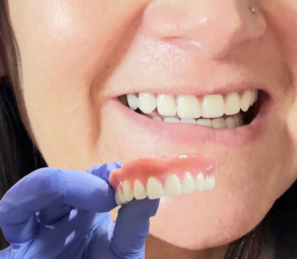 Acrylic False Teeth Only | DIY Denture Making Repair Upper Lower No Base