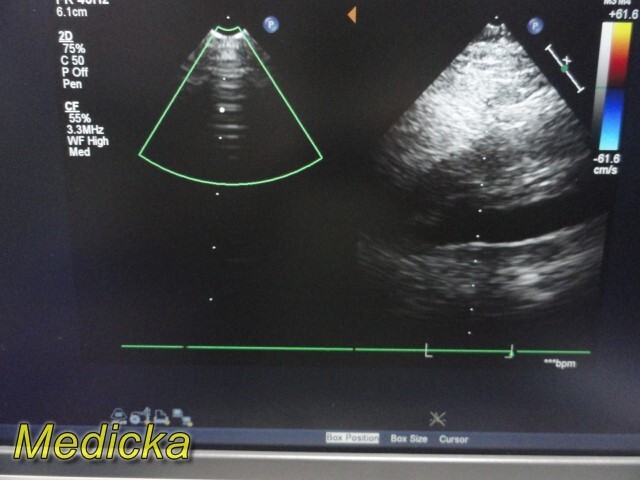 Philips X7-2 Matrix Sector Array Ultrasound Transducer Ref 453561192603 ~ 36256