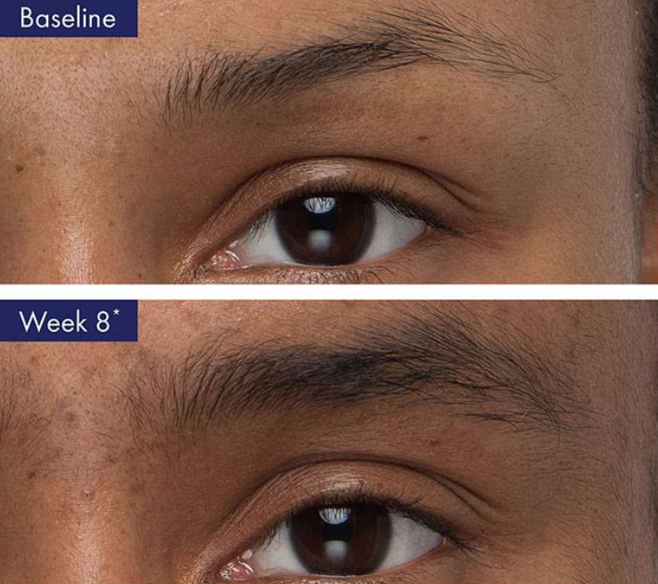 Obagi Nu-Cil™ Eyebrow Boosting Serum 0.17 fl oz