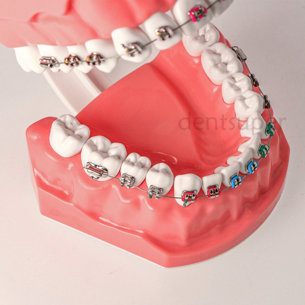 US 1:1 Dental Orthodontic Teeth Model Typodont Demonstration Model with Brackets
