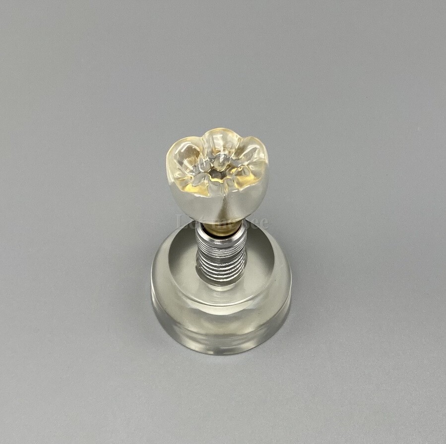 Dental Implant Model Detachable Demonstration Teeth Study Teach Model M2020