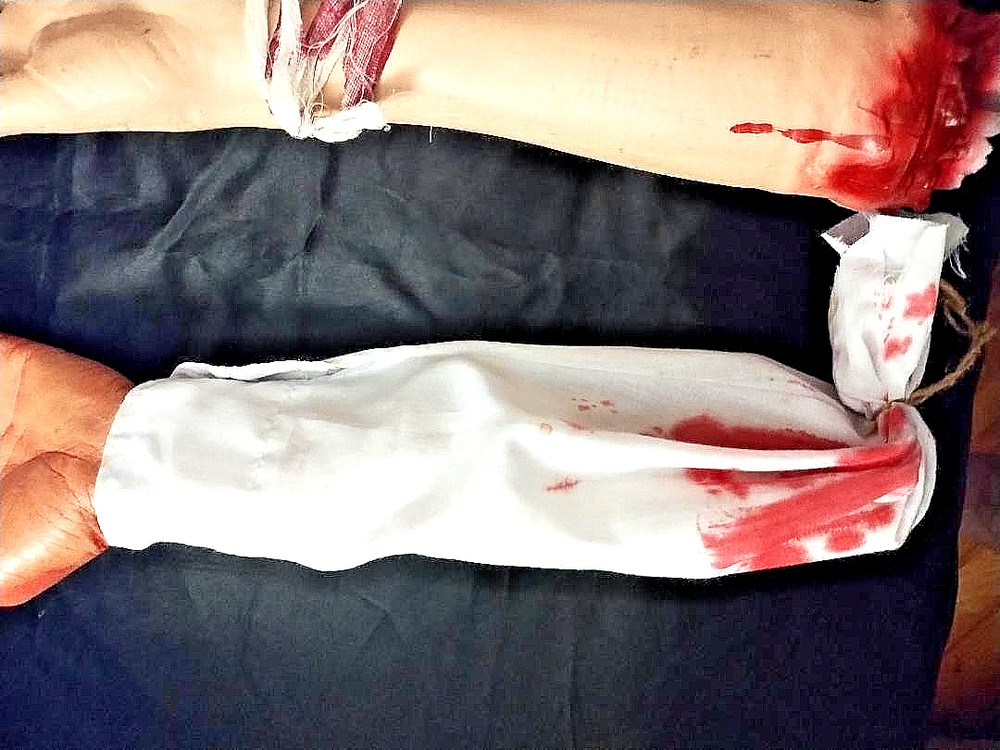 Halloween Severed Arm Prop Decorations