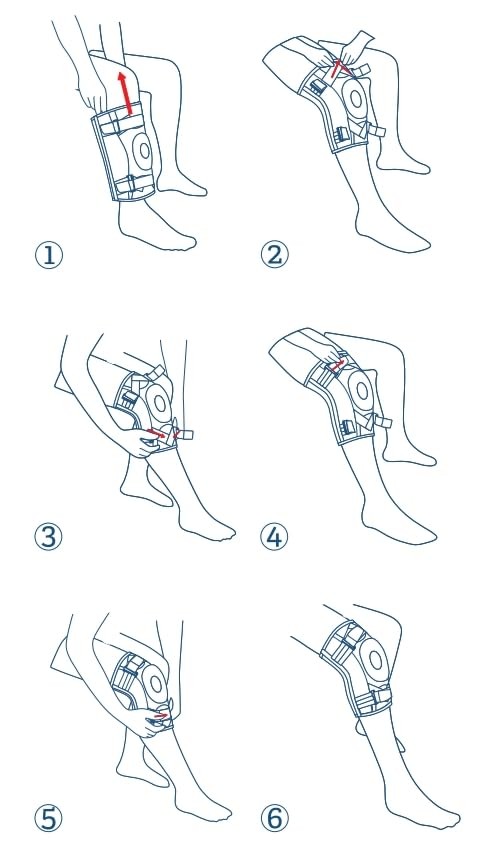 NEENCA Hinged Knee Brace Knee Immobilizer with Locking Dials & Side Stabilize...