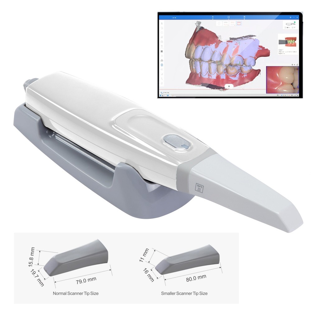 Dental Intra-oral 3D Scanner with Scanning Software