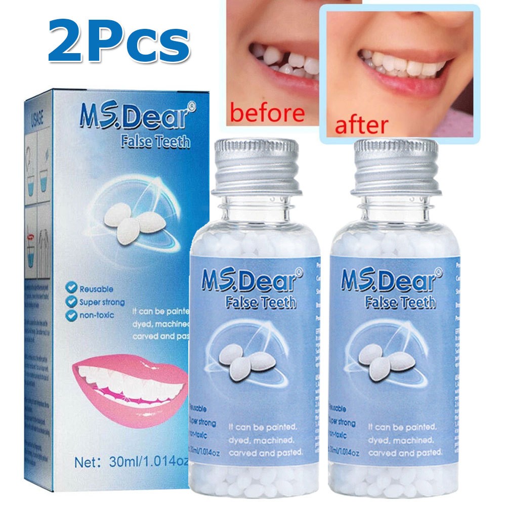 Tooth Repair Kit, Moldable False Teeth Beads for Filling Missing & Broken Tooth