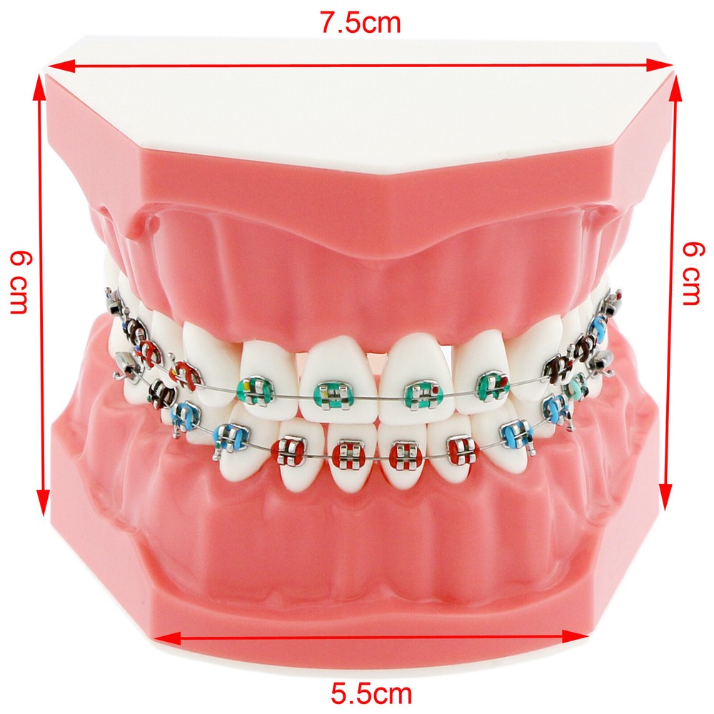 US Dental Typodont Demonstration Teach Teeth Model with Braces For Patient Study