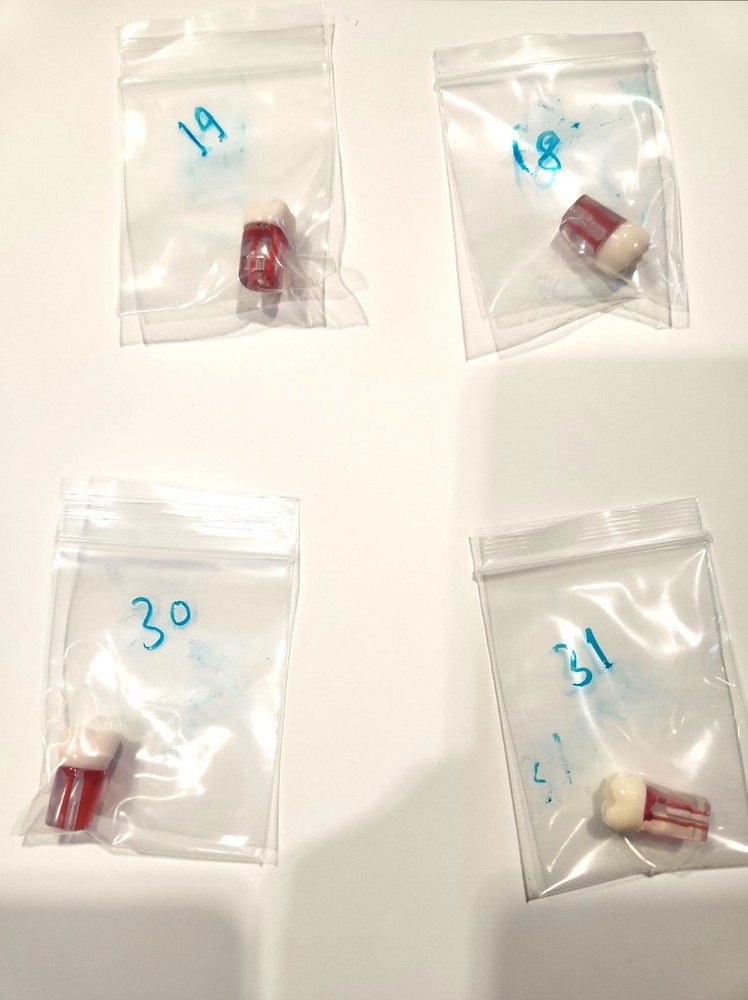 Dental Transparent Root Canal Study Model