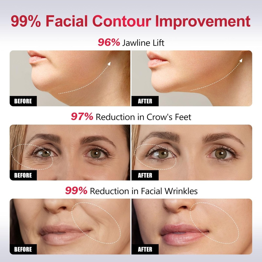 2-in-1 Red Light Microcurrent Facial Device | Enhances Lifting & Firming Capa...