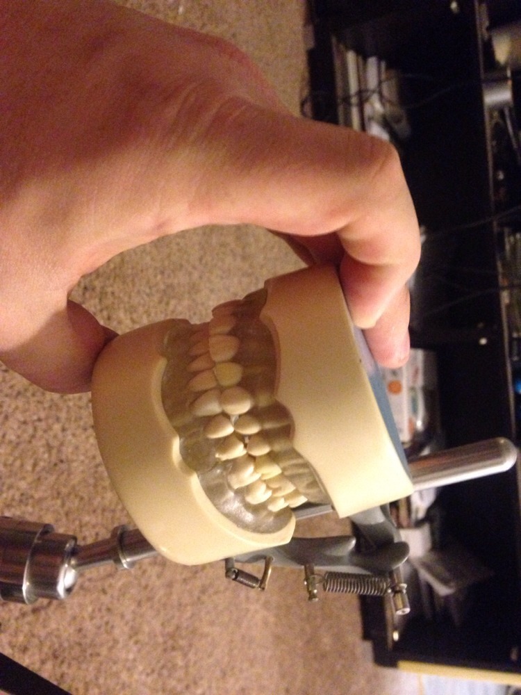 Dental Typodont Mounted On A Pole