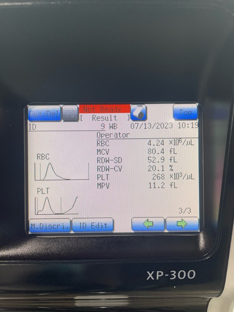 Sysmex XP-300 Automated Hematology Analyzer