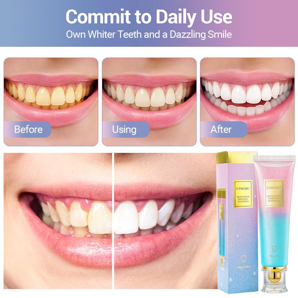 Niacinamide Brightening Toothpaste Deep Clean Toothpaste Gum Health Toothpaste