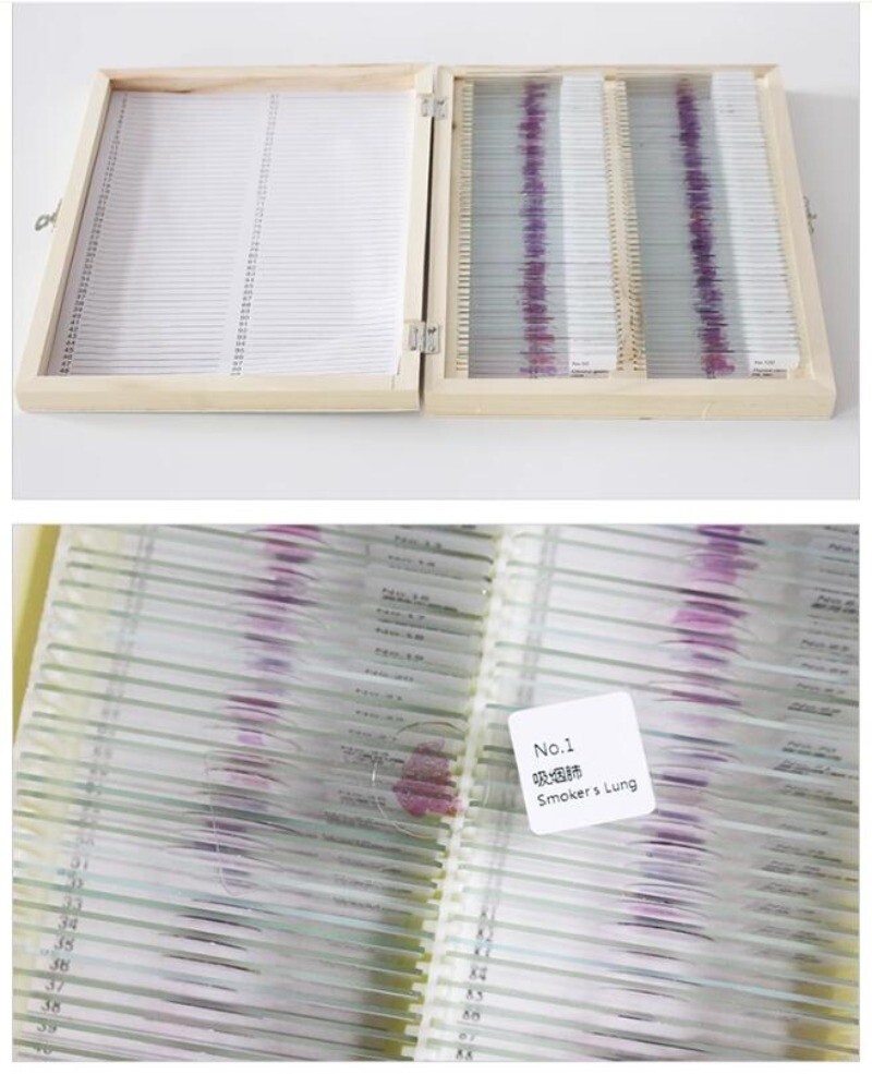 100PCS Mammal Pathological Section Typical Prepared Specimen Slides