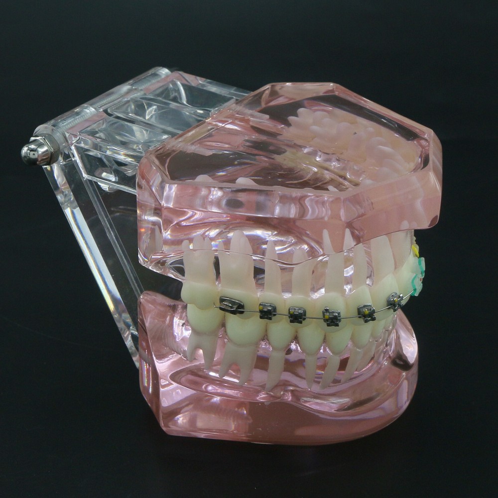 Dental Orthodontic Teeth Model + Self-ligating Metal Ceramic Bracket Retainer