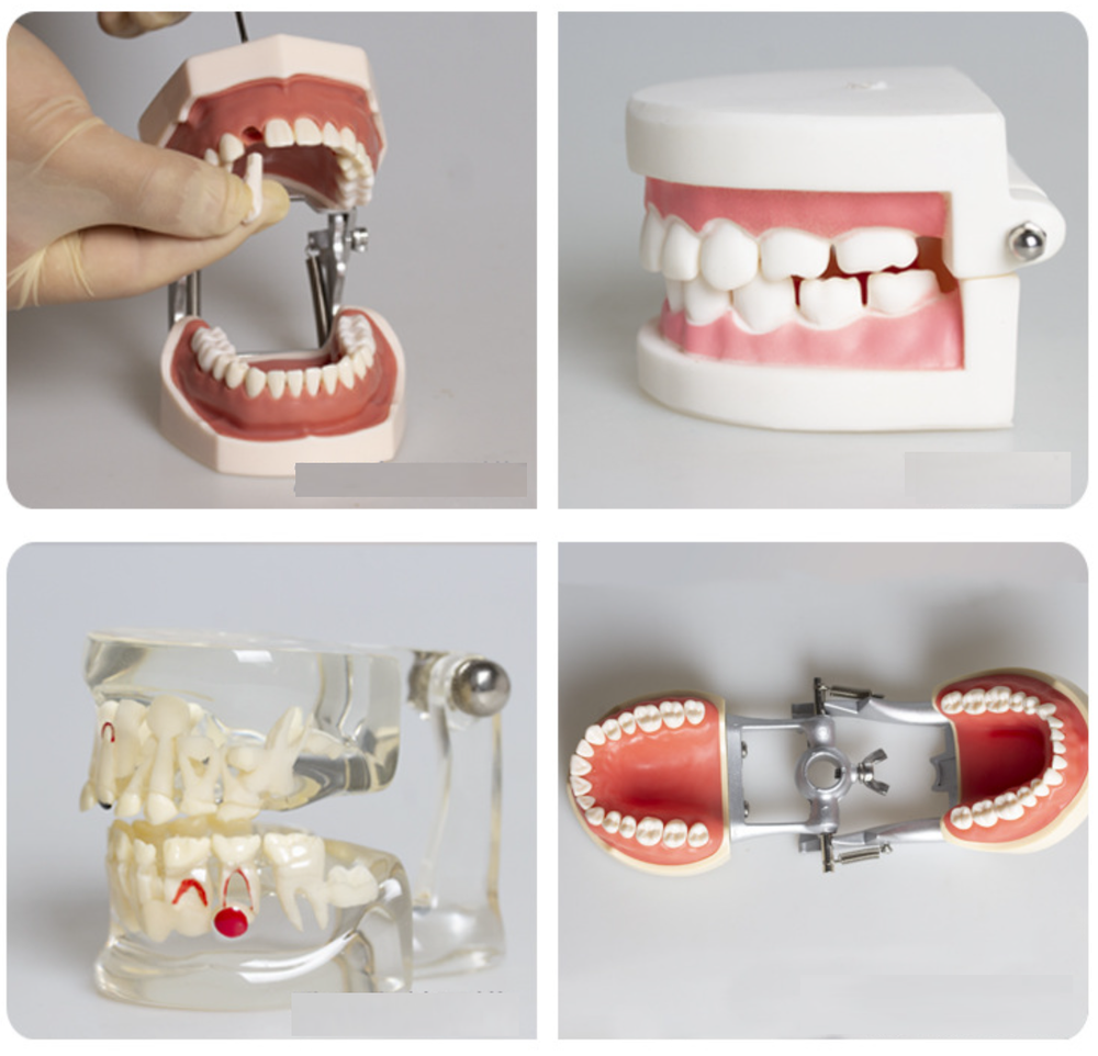 Dental Typodont Teeth Study Teach Tooth Model Implant Endo Caries Demonstration