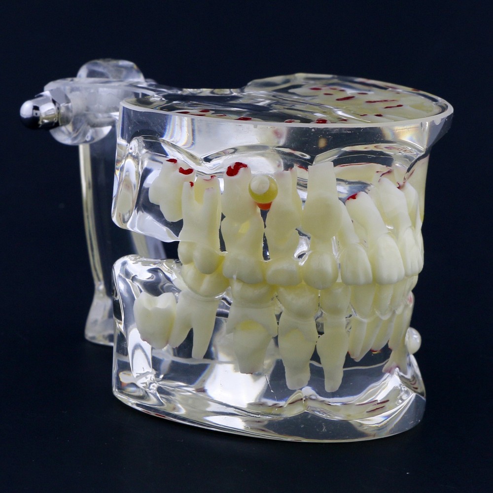 Dental Children Pediatric Pathology Demonstration Study Tooth Teeth Model 4002