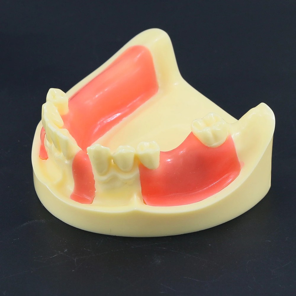 Dental Model Mandibular Jaw Study Education Teach with Gingiva for Flap Drilling