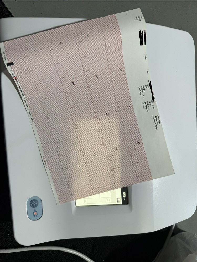 Welch Allyn CP150 Digital ECG Machine Printer with Spirometer