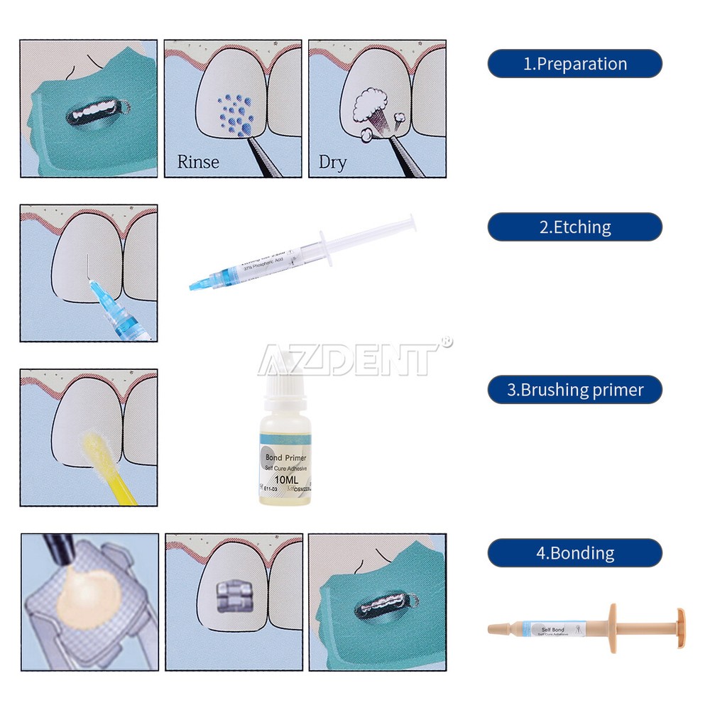 Dental Ortho Direct Paste Adhesive Bonding Self Curing Composite Resin Kit
