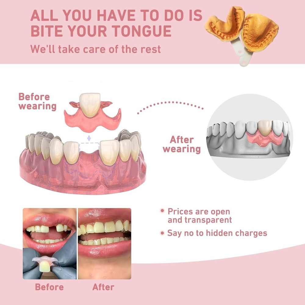 Custom Partial Dentures – Personalized Removable Denture Set for Missing Teeth