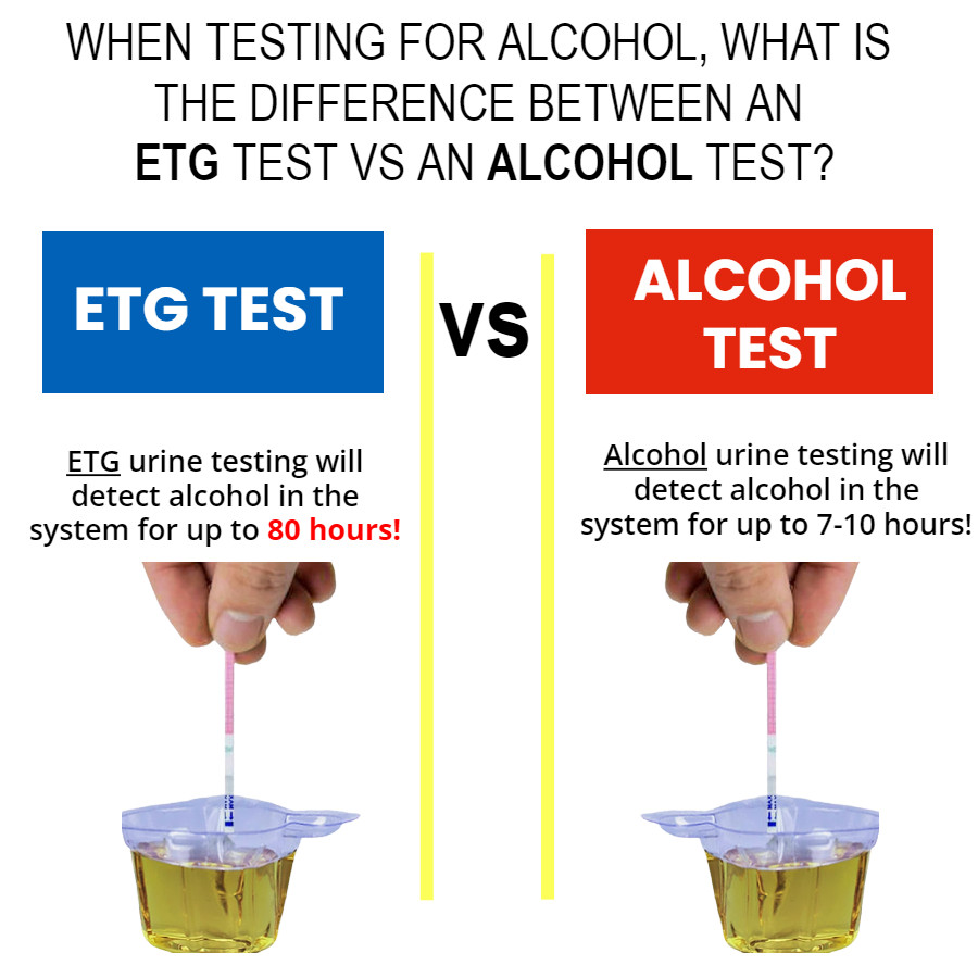 Alcohol (ETG) Testing Strips Rapid Urine Test Strips 80 Hour Detection | 25 PacK
