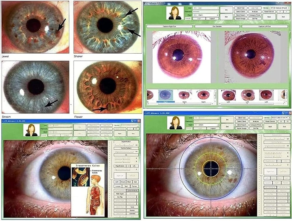 Iridology Camera Iriscope Iris Analyzer Iridology Camera with English Software