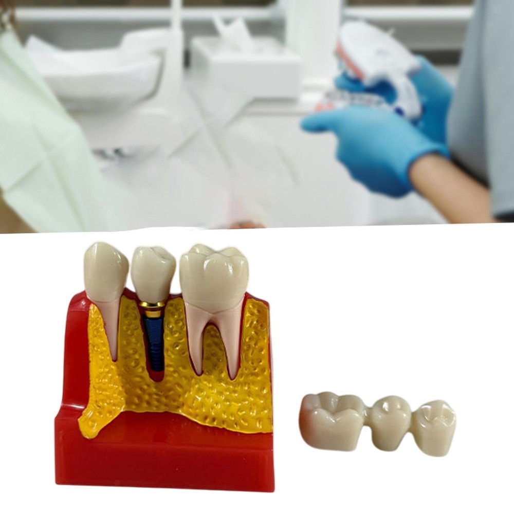 4 Times Tooth Model Tooth Teaching Display Model for Students Kids Patients