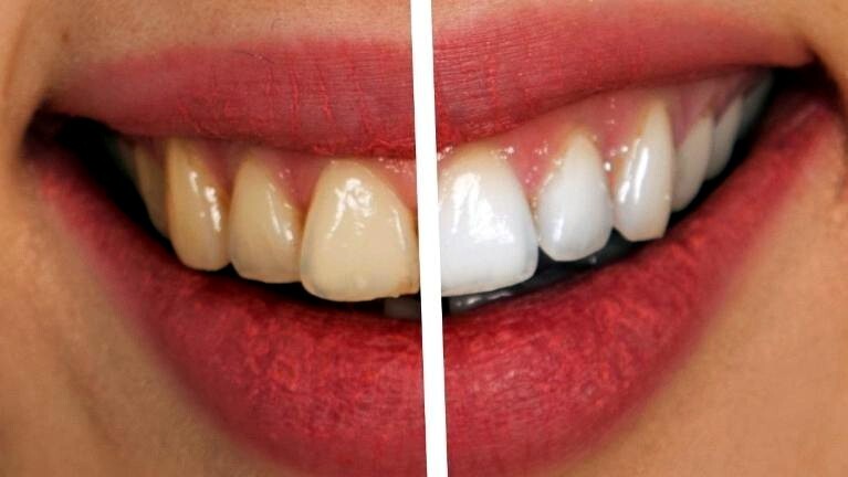 FLUORIDE FREE MINT TOOTHPASTE Natural Bamboo Activated Charcoal Teeth Whitening