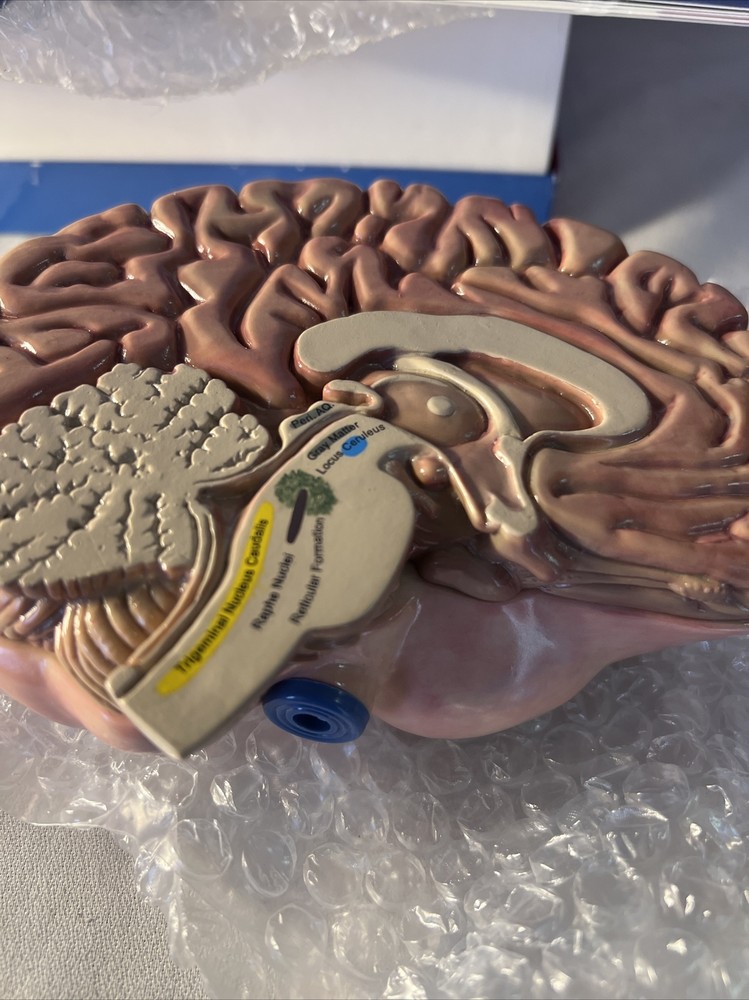 3-D Maxalt Merck An Inside Look At Migraine Teaching Tool