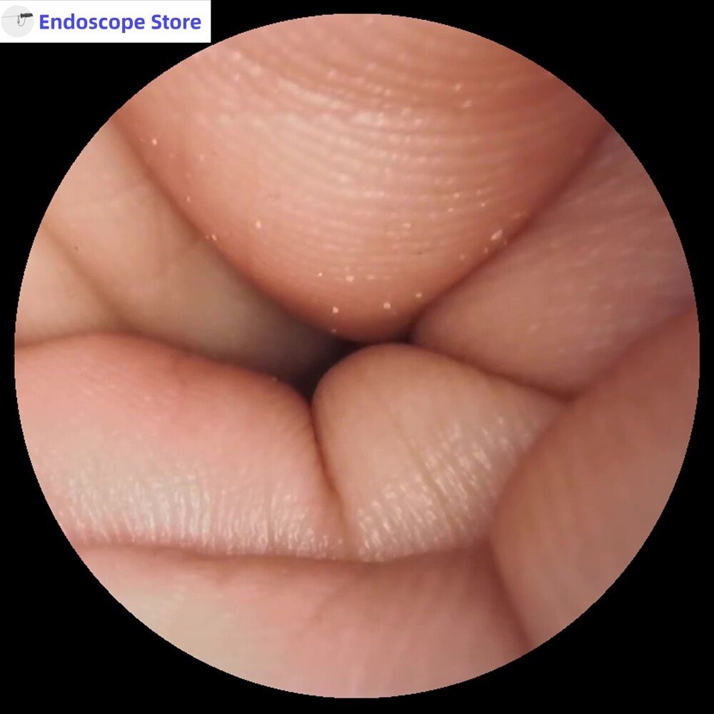 Medical Right Laparoscopic Angle Adapter Endoscope Light Source Optical Fiber