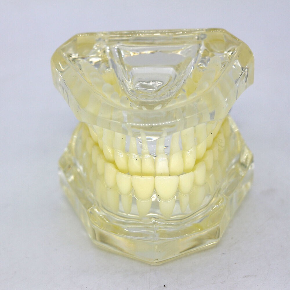 1×Yellow Transparent Plastic Study Teeth Model Demonstrate Comprehensive Repair