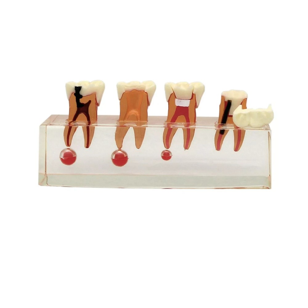 Dental Endodontic Treatment Study Teaching Typodont Teeth 4018 Model 4 Stage