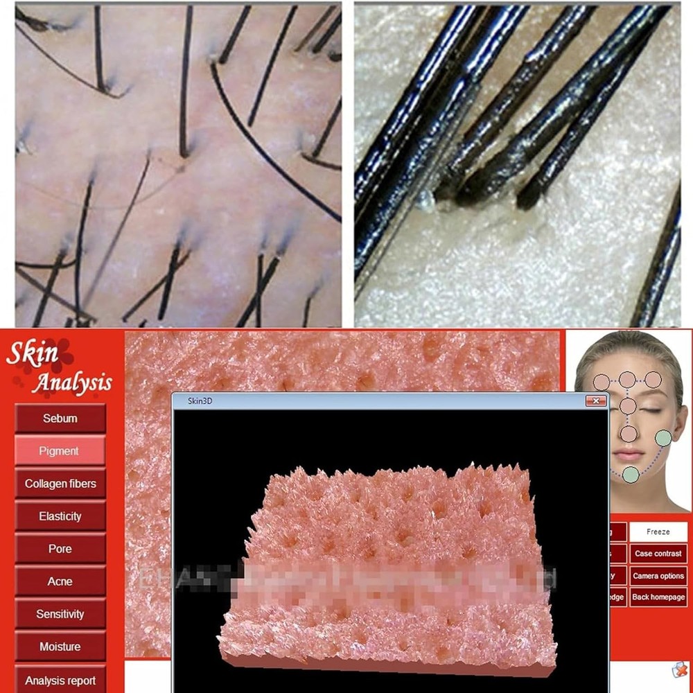 Iridology Camera Iriscope Iris Analyzer Iridology Camera with English Software