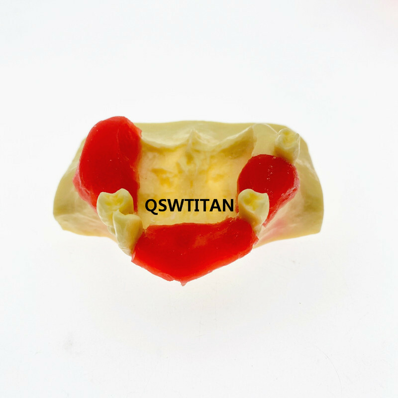 Dental Sinus Lift Practice Teeth Model Typodont Study Tooth Model M2012