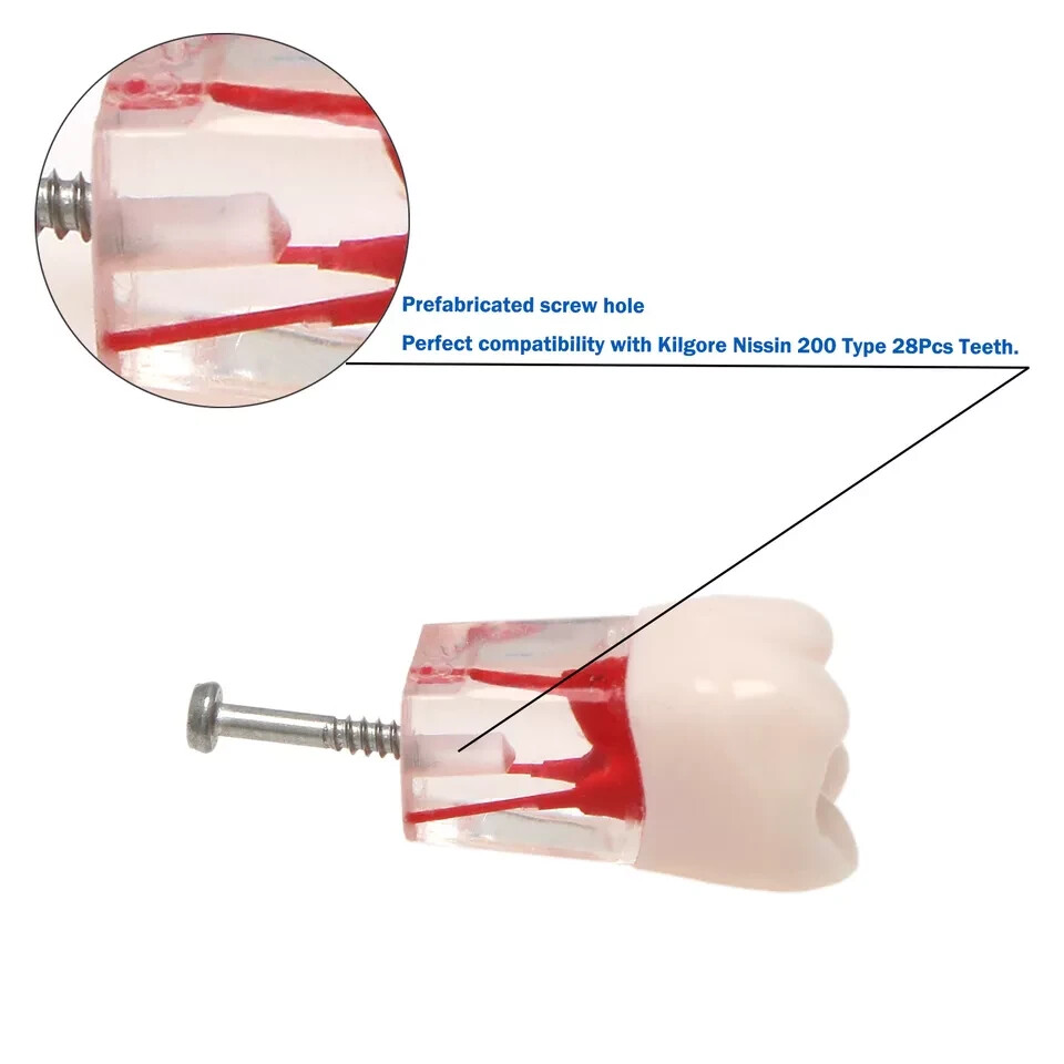 10Pcs Dental Root Canal Practice Teeth Model for Pulp Study RCT Endo File 16#